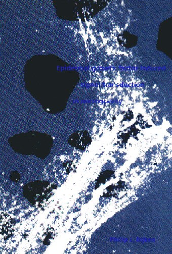 Epidermal growth factor-induced signal transduction in microgravity.